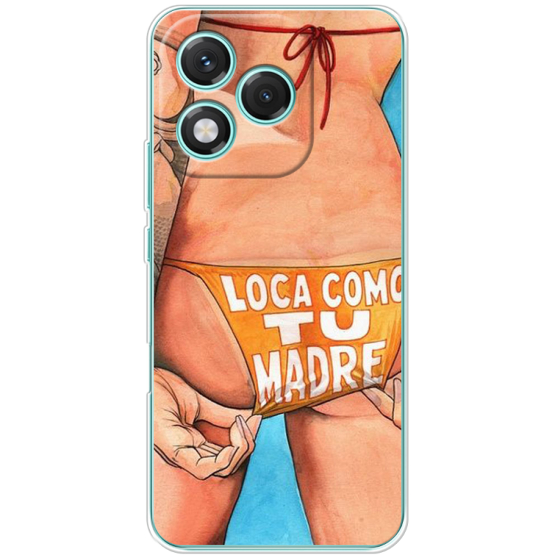 Чохол BoxFace Honor 400 Lite 