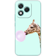 Чохол BoxFace Honor 400 Lite 