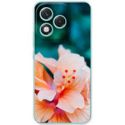 Чохол BoxFace Honor 400 Lite 