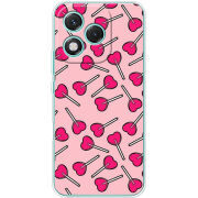 Чохол BoxFace Honor 400 Lite 