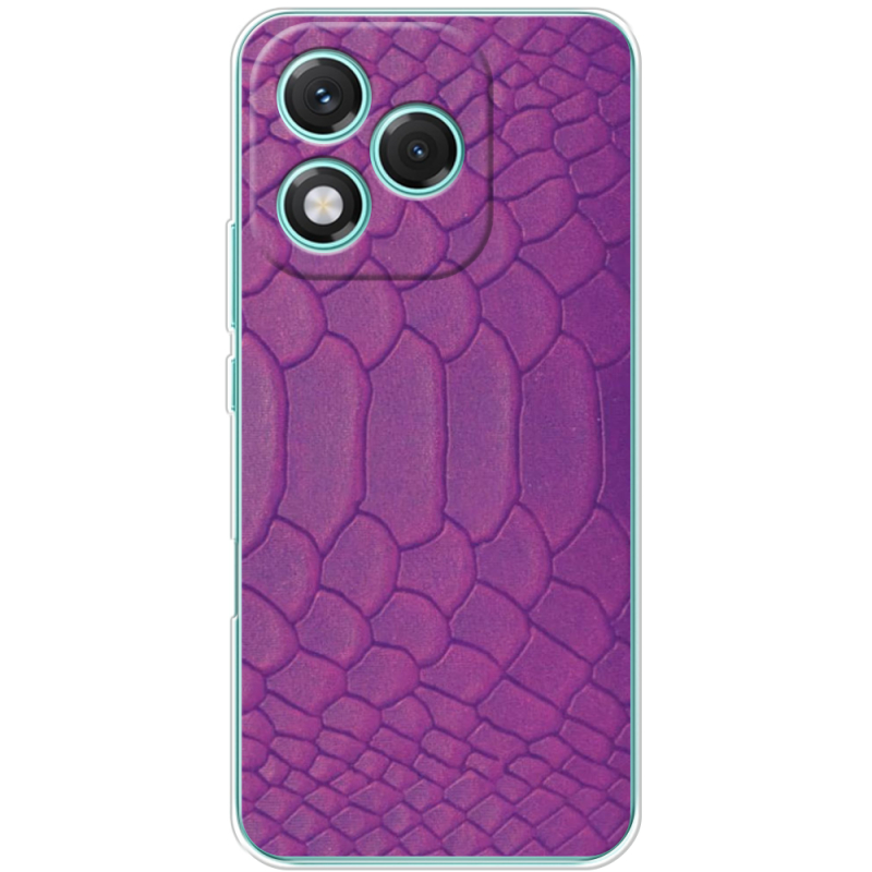 Чохол BoxFace Honor 400 Lite 