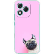 Чохол BoxFace Honor 400 Lite 