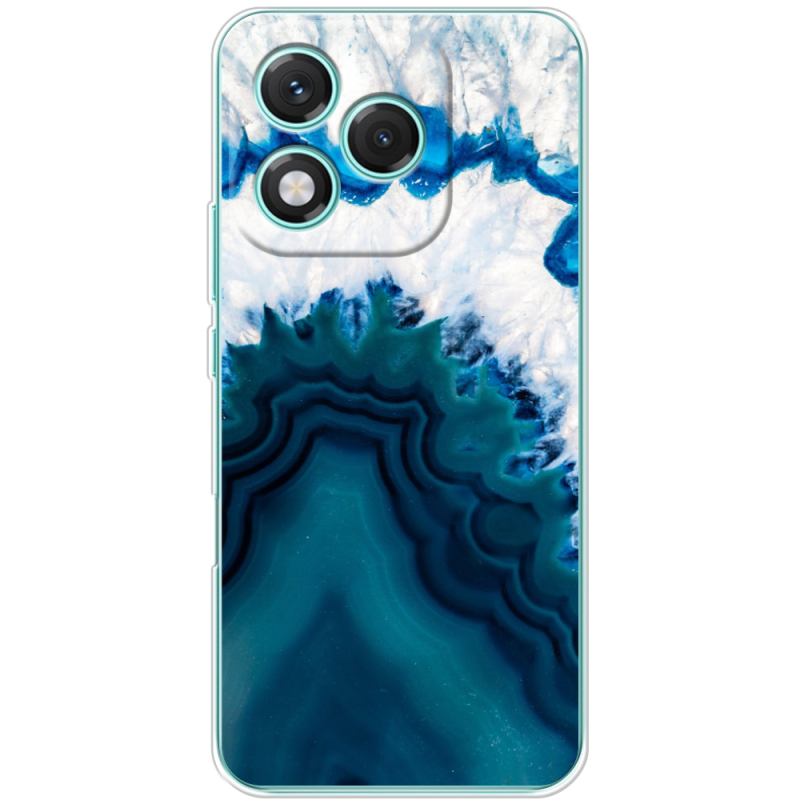 Чохол BoxFace Honor 400 Lite 