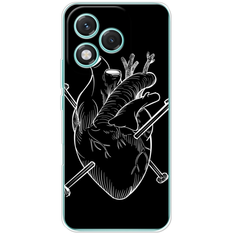 Чохол BoxFace Honor 400 Lite 