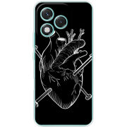 Чохол BoxFace Honor 400 Lite 