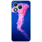 Чохол BoxFace Honor 400 Lite 