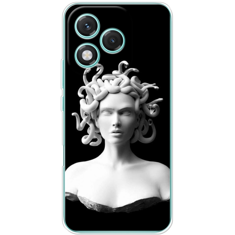 Чохол BoxFace Honor 400 Lite 