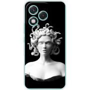 Чохол BoxFace Honor 400 Lite 