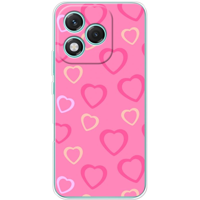 Чохол BoxFace Honor 400 Lite Sugar Hearts