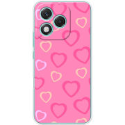 Чохол BoxFace Honor 400 Lite Sugar Hearts