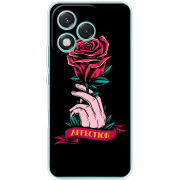 Чохол BoxFace Honor 400 Lite 