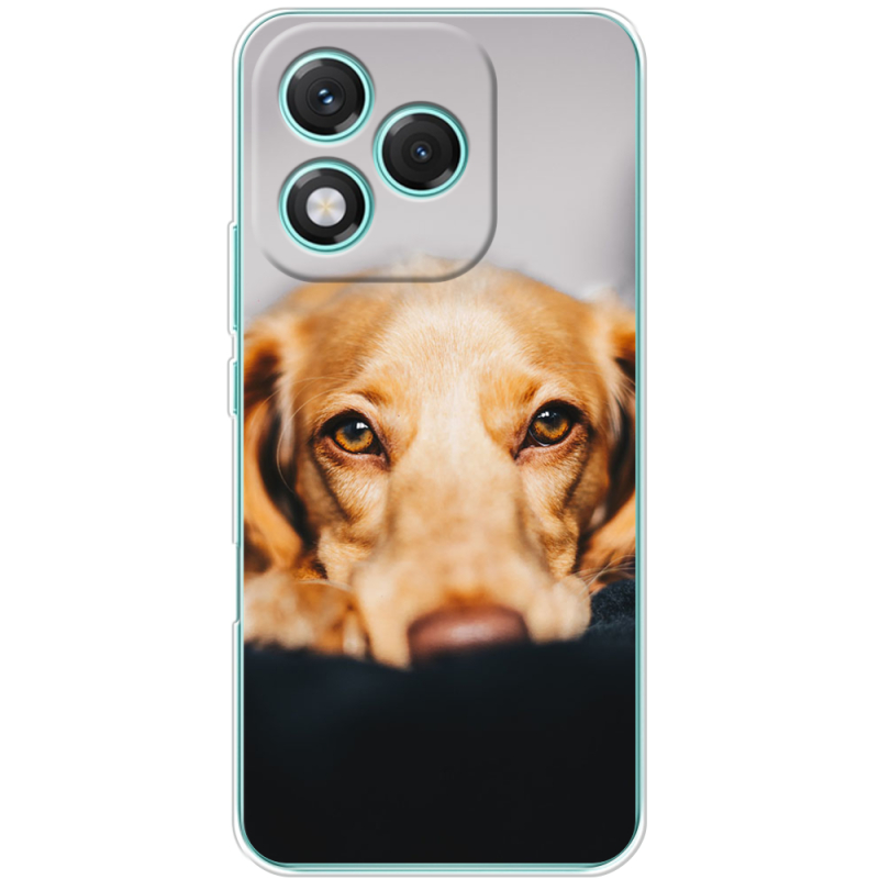 Чохол BoxFace Honor 400 Lite 