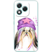 Чохол BoxFace Honor 400 Lite 