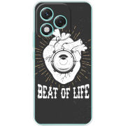 Чохол BoxFace Honor 400 Lite 