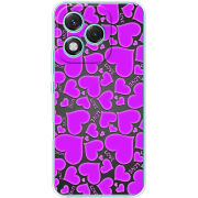 Чохол BoxFace Honor 400 Lite 