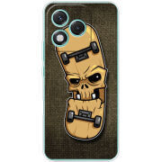 Чохол BoxFace Honor 400 Lite 