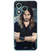 Чохол BoxFace Honor 400 Lite 