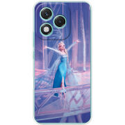 Чохол BoxFace Honor 400 Lite 