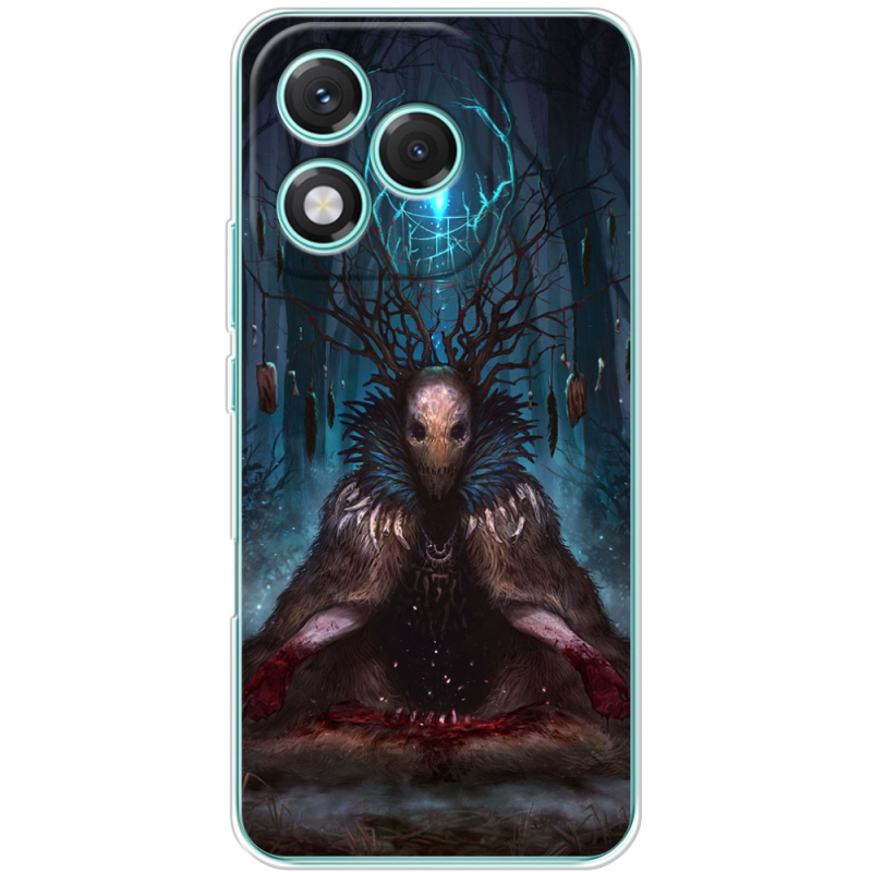 Чохол BoxFace Honor 400 Lite 