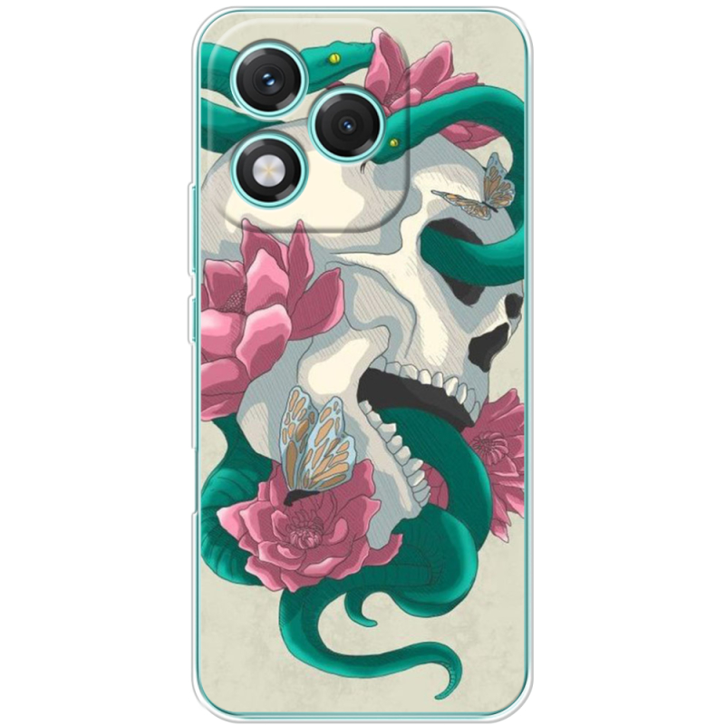 Чохол BoxFace Honor 400 Lite 