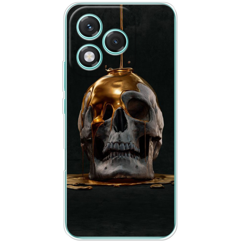 Чохол BoxFace Honor 400 Lite 