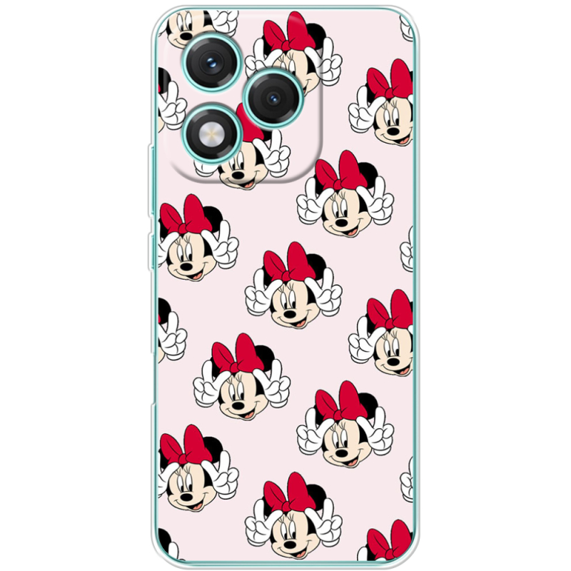 Чохол BoxFace Honor 400 Lite 