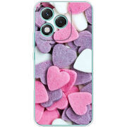 Чохол BoxFace Honor 400 Lite Сердечки