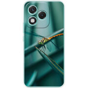 Чохол BoxFace Honor 400 Lite 