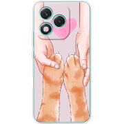 Чохол BoxFace Honor 400 Lite 