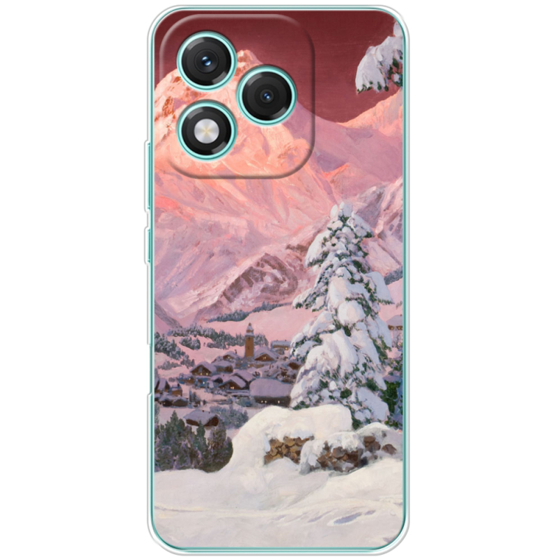 Чохол BoxFace Honor 400 Lite 