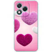 Чохол BoxFace Honor 400 Lite 