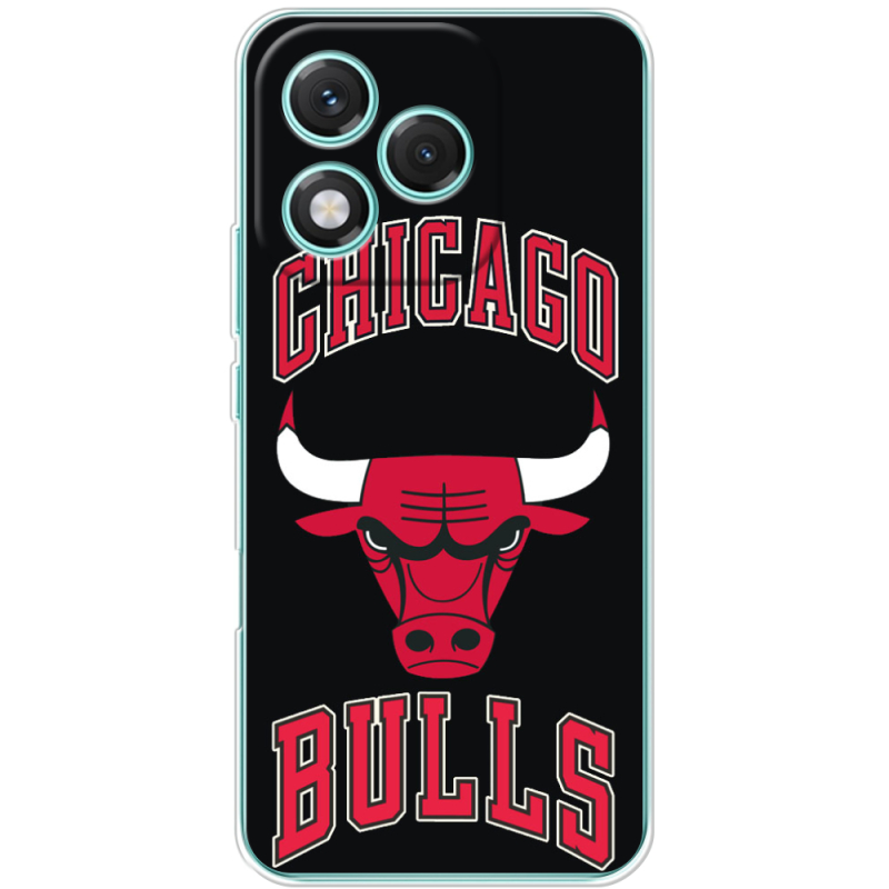 Чохол BoxFace Honor 400 Lite 