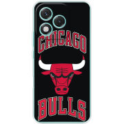 Чохол BoxFace Honor 400 Lite 