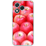 Чохол BoxFace Honor 400 Lite 