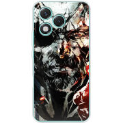 Чохол BoxFace Honor 400 Lite 