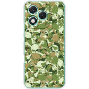 Чохол BoxFace Honor 400 Lite 