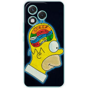 Чохол BoxFace Honor 400 Lite 