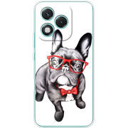 Чохол BoxFace Honor 400 Lite 