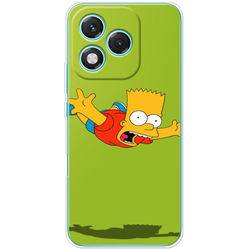 Чохол BoxFace Honor 400 Lite 