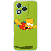 Чохол BoxFace Honor 400 Lite 