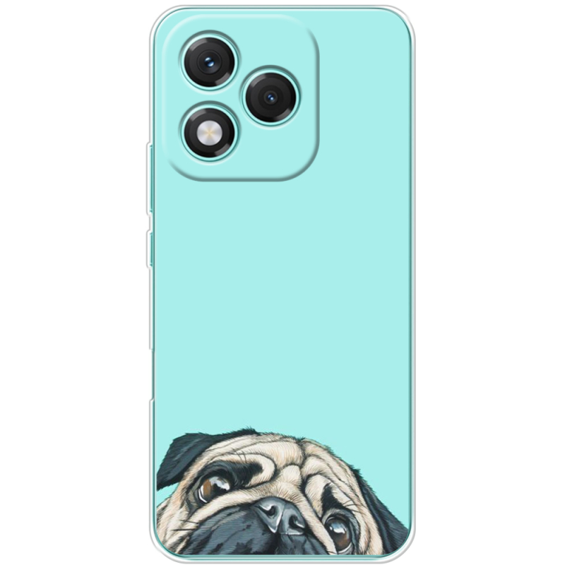 Чохол BoxFace Honor 400 Lite 