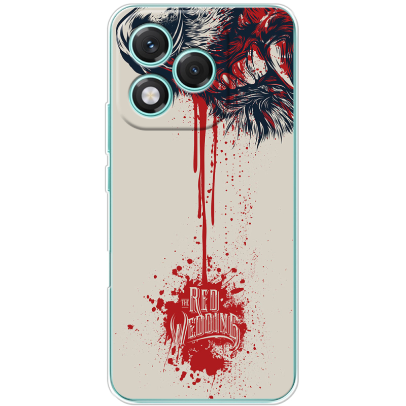 Чохол BoxFace Honor 400 Lite 