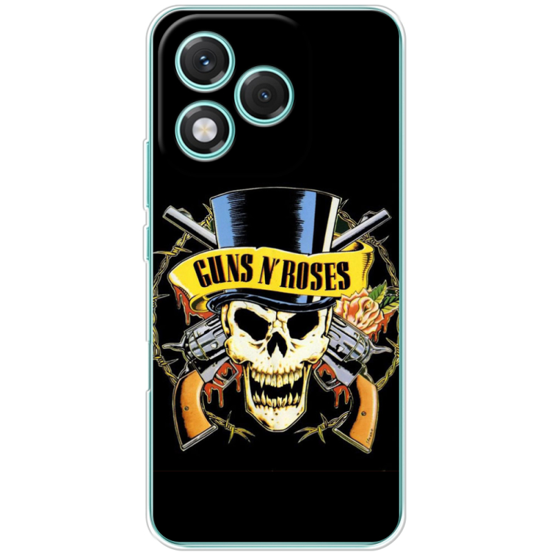 Чохол BoxFace Honor 400 Lite 