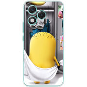 Чохол BoxFace Honor 400 Lite 