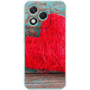 Чохол BoxFace Honor 400 Lite 