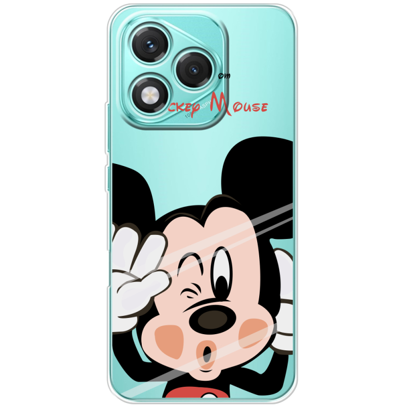 Прозорий чохол BoxFace Honor 400 Lite Mister M