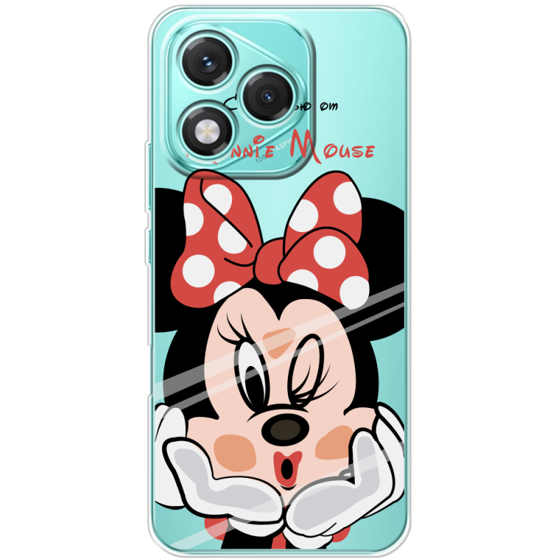 Прозорий чохол BoxFace Honor 400 Lite Lady M