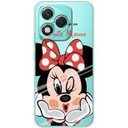 Прозорий чохол BoxFace Honor 400 Lite Lady M