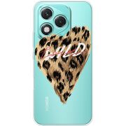 Прозорий чохол BoxFace Honor 400 Lite Wild Love