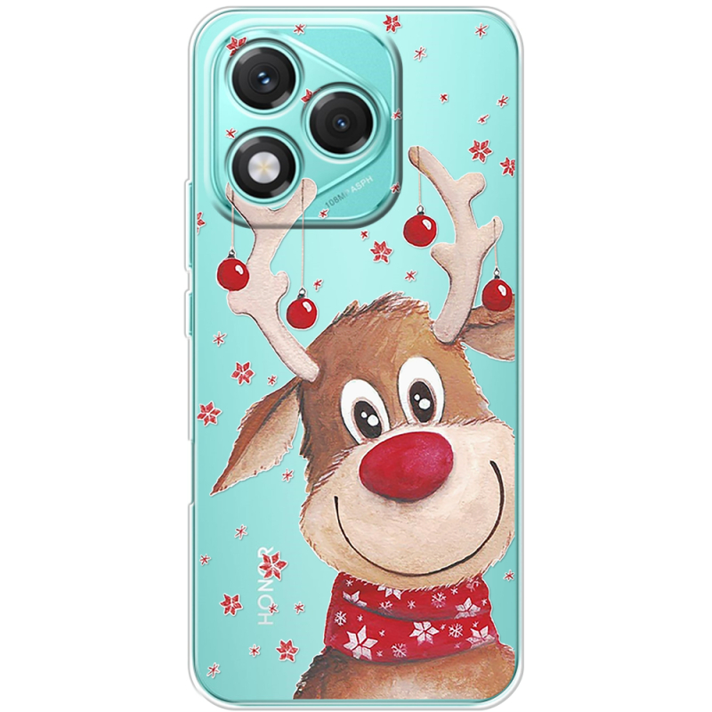 Прозорий чохол BoxFace Honor 400 Lite Winter Deer